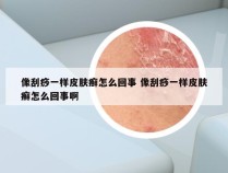 像刮痧一样皮肤癣怎么回事 像刮痧一样皮肤癣怎么回事啊