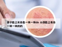 孩子脸上长白色一块一块de 小孩脸上有白一块一块的的