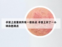 手背上皮里肉外有一些白点 手背上长了一小块白色斑点