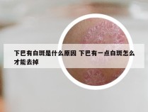 下巴有白斑是什么原因 下巴有一点白斑怎么才能去掉