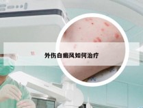 外伤白癜风如何治疗