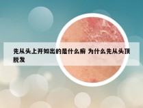 先从头上开如出的是什么癣 为什么先从头顶脱发