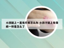 小孩腿上一直有片癣怎么办 小孩子腿上有像癣一样是怎么了