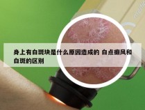 身上有白斑块是什么原因造成的 白点癫风和白斑的区别