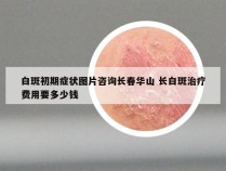 白斑初期症状图片咨询长春华山 长白斑治疗费用要多少钱