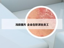 浅藓图片 企业在职派驻员工