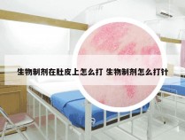 生物制剂在肚皮上怎么打 生物制剂怎么打针