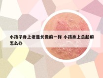 小孩子身上老是长像癣一样 小孩身上总起癣怎么办