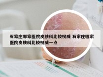 石家庄哪家医院皮肤科比较权威 石家庄哪家医院皮肤科比较权威一点