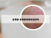 金发藓 金发藓有输导组织吗