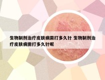 生物制剂治疗皮肤病需打多久针 生物制剂治疗皮肤病需打多久针呢