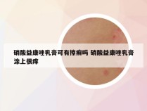 硝酸益康唑乳膏可有擦癣吗 硝酸益康唑乳膏涂上很痒