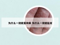 为什么一挠就是块癣 为什么一挠就起皮