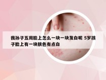 我孙子五周脸上怎么一块一块发白呢 5岁孩子脸上有一块肤色有点白