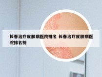 长春治疗皮肤病医院排名 长春治疗皮肤病医院排名榜