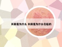 长藓是为什么 长藓是为什么引起的