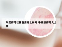 牛皮癣可以抹医用凡士林吗 牛皮肤癣用凡士林