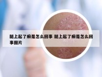 腿上起了癣是怎么回事 腿上起了癣是怎么回事图片