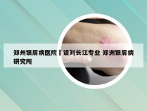 郑州银屑病医院來请刘长江专业 郑洲银屑病研究所