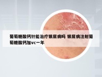 葡萄糖酸钙针能治疗银屑病吗 银屑病注射葡萄糖酸钙加vc一年