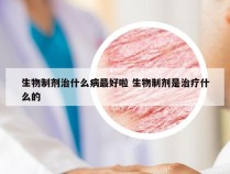 生物制剂治什么病最好啦 生物制剂是治疗什么的