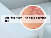 屁股上的皮肤出现一个白点 屁股上长了白色的点