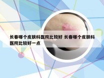 长春哪个皮肤科医院比较好 长春哪个皮肤科医院比较好一点