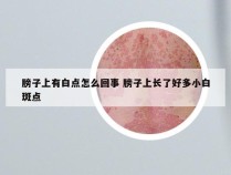 膀子上有白点怎么回事 膀子上长了好多小白斑点