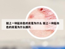 腿上一块起白色的皮是为什么 腿上一块起白色的皮是为什么图片