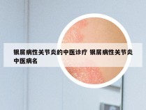 银屑病性关节炎的中医诊疗 银屑病性关节炎中医病名