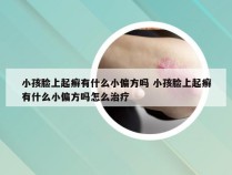 小孩脸上起癣有什么小偏方吗 小孩脸上起癣有什么小偏方吗怎么治疗