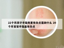 22个月孩子手指夹里有白点是缺什么 20个月宝宝手指盖有白点