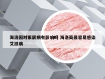 海洛因对银屑病有影响吗 海洛英最容易感染艾滋病