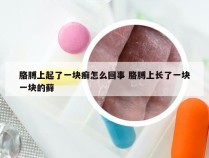 胳膊上起了一块癣怎么回事 胳膊上长了一块一块的藓