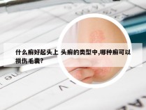 什么癣好起头上 头癣的类型中,哪种癣可以损伤毛囊?