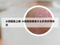 小孩屁股上癣 小孩屁股癣用什么药膏好得快点