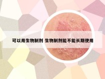 可以用生物制剂 生物制剂能不能长期使用