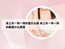 身上长一块一块的是什么癣 身上长一块一块的癣是什么原因