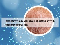 是不是打了生物制剂后每个月都要打 打了生物制剂还需要吃药吗