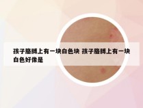 孩子胳膊上有一块白色块 孩子胳膊上有一块白色好像是