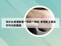 为什么宝宝脸黑一块白一块的 宝宝脸上黑白不均匀的原因