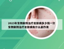 2023年生物制剂治疗皮肤病多少钱一针 生物制剂治疗皮肤病有什么副作用