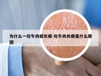 为什么一吃牛肉就长癣 吃牛肉长癣是什么原因