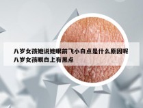 八岁女孩她说她眼前飞小白点是什么原因呢 八岁女孩眼白上有黑点