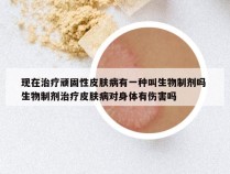 现在治疗顽固性皮肤病有一种叫生物制剂吗 生物制剂治疗皮肤病对身体有伤害吗