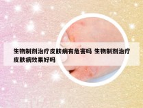 生物制剂治疗皮肤病有危害吗 生物制剂治疗皮肤病效果好吗