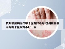 杭州银屑病治疗哪个医院好不好 杭州银屑病治疗哪个医院好不好一点