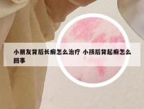 小朋友背后长癣怎么治疗 小孩后背起癣怎么回事