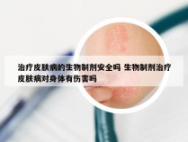 治疗皮肤病的生物制剂安全吗 生物制剂治疗皮肤病对身体有伤害吗