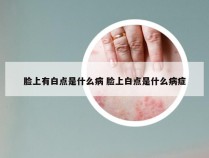 脸上有白点是什么病 脸上白点是什么病症